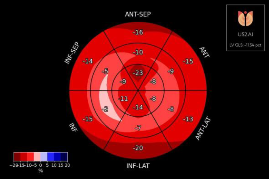Strain Bullseye